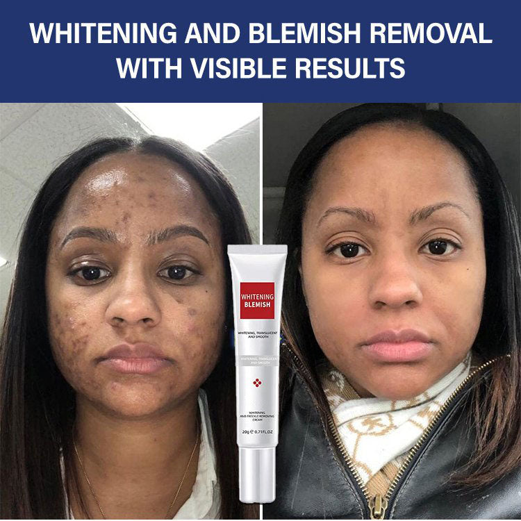 Whitening and Spot-Removing Cream💦