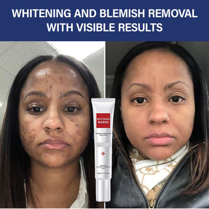 Whitening and Spot-Removing Cream💦