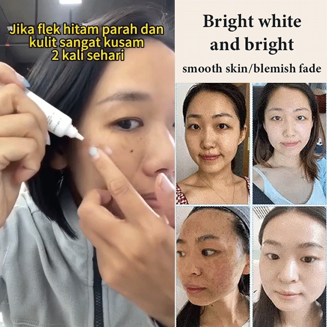 Whitening and Spot-Removing Cream💦